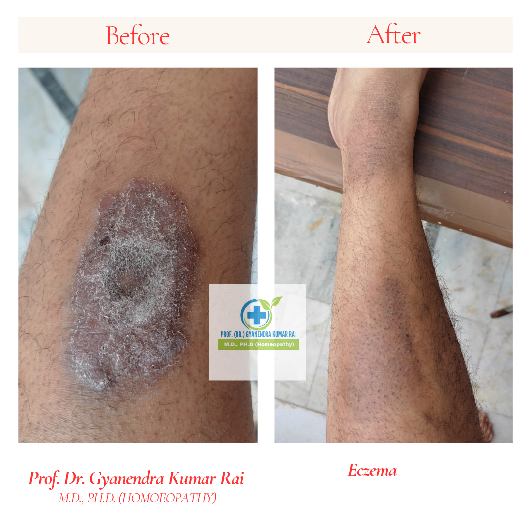 Copy of Copy of Copy of Copy of Neutral Before and After Instagram Post_20260317_132957_0000