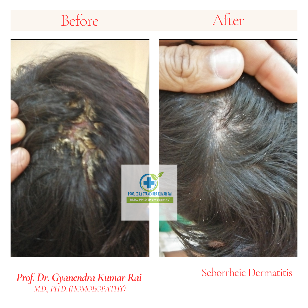 Copy of Copy of Copy of Neutral Before and After Instagram Post_20260317_132708_0000