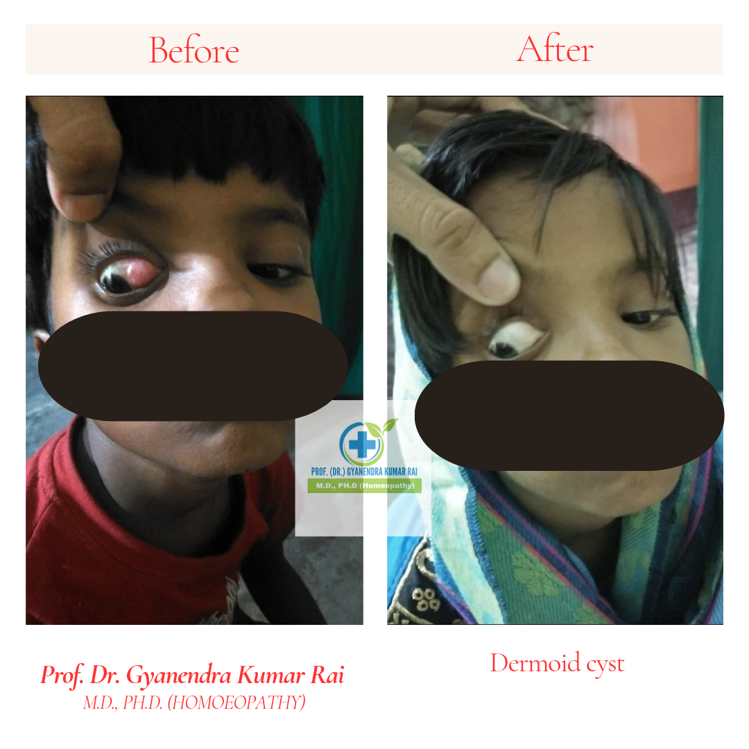 Copy of Copy of Neutral Before and After Instagram Post_20260317_135509_0000