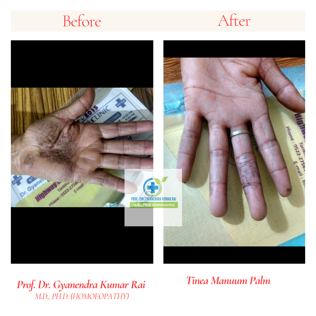 Copy of Neutral Before and After Instagram Post_20260317_131736_0000